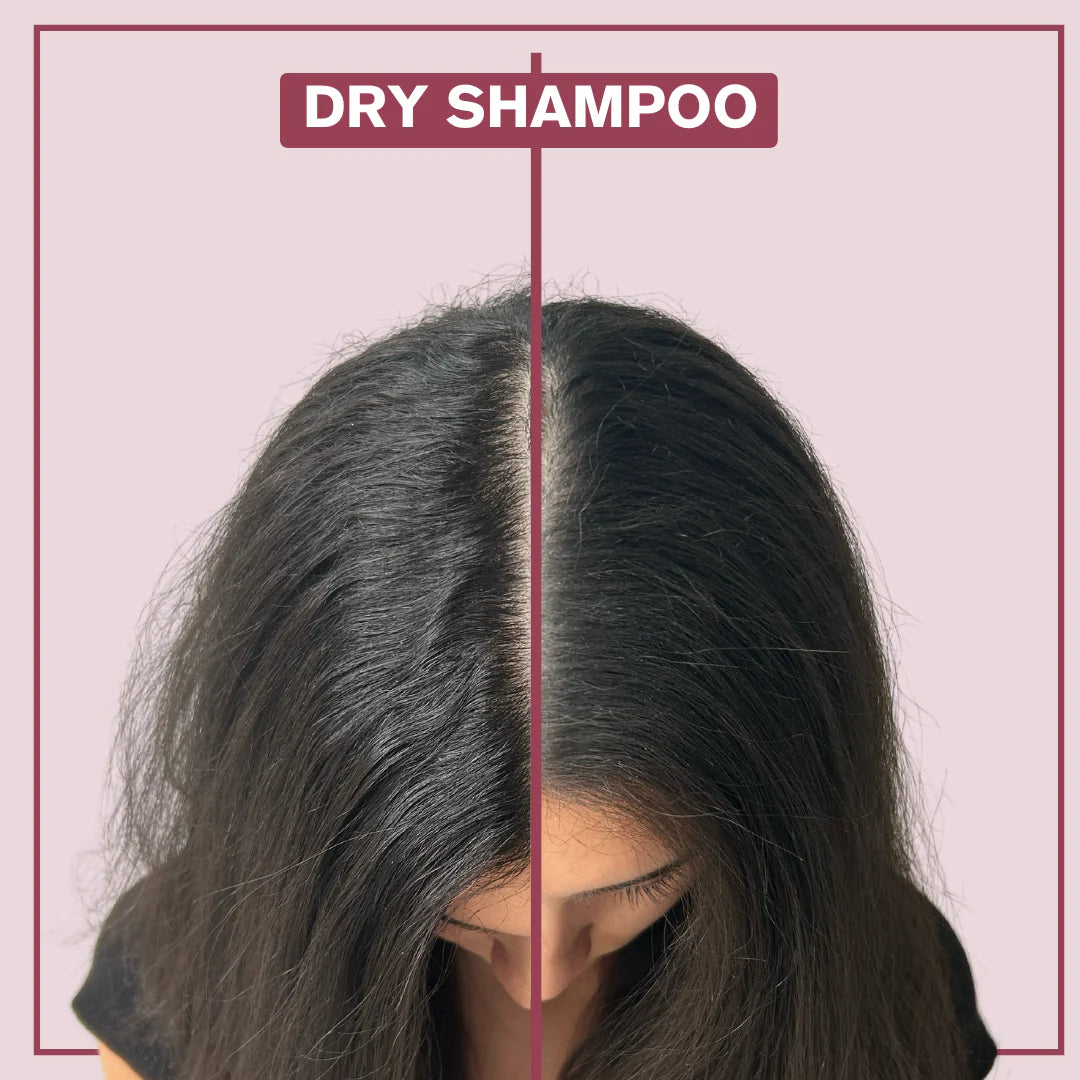 Alcove Dry Shampoo 🇨🇦