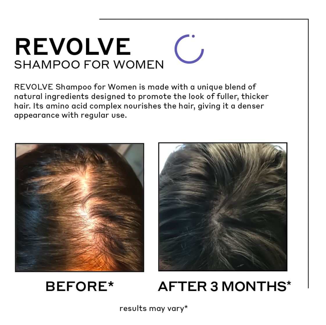 Revolve Women's Trio Kit