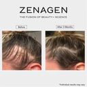Zenagen Revolve Women's Thickening Shampoo